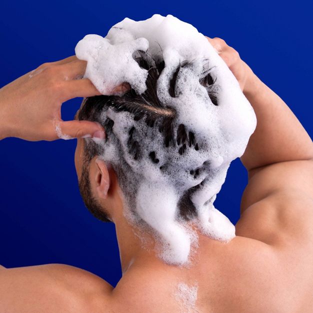 Head & Shoulder Cupid Beauty Supplies Shampoo Head & Shoulders Clinical Strength Anti-Dandruff Shampoo for Dry Scalp with 1% Selenium Sulfide Fights Seborrheic Dermatitis